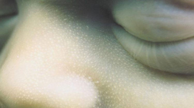 La historia detrás de la portada de “Mutter” de Rammstein